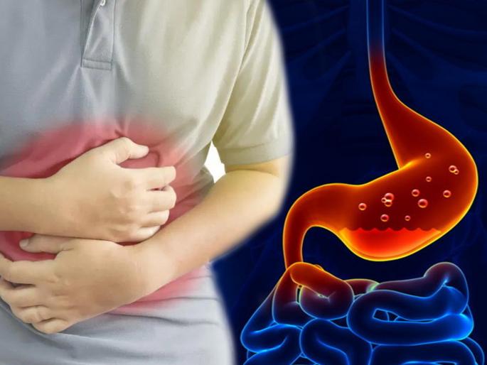 Home remedies to eliminate stomach irritation, you will get instant relief | पोटात सतत जळजळ होत असेल तर 'या' घरगुती उपायांनी मिळेल आराम Home remedies to eliminate stomach irritation, you will get instant relief | पोटात सतत जळजळ होत असेल तर 'या' घरगुती उपायांनी मिळेल आराम