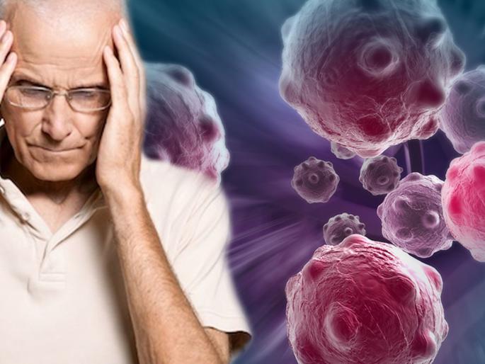 Common cancer in indian men and essential tests for screening or-diagnosis | पुरूषांना सर्वाधिक असतो 'या' ४ कॅन्सरचा धोका, शिकार होण्याआधी जाणून घ्या कारणं Common cancer in indian men and essential tests for screening or-diagnosis | पुरूषांना सर्वाधिक असतो 'या' ४ कॅन्सरचा धोका, शिकार होण्याआधी जाणून घ्या कारणं