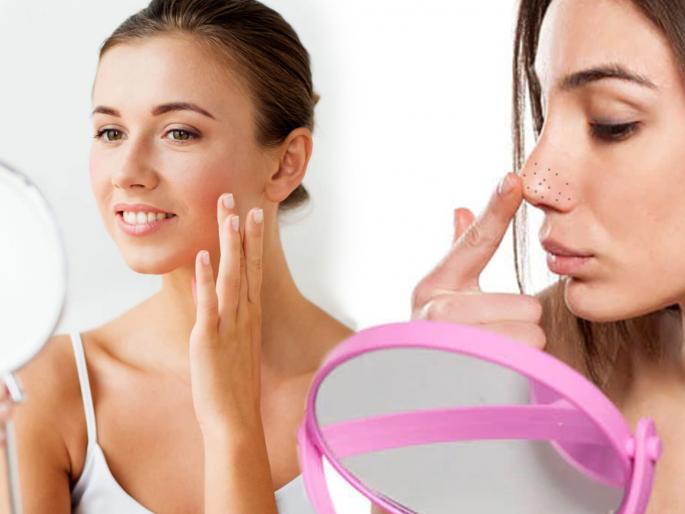 How to remove blackheads by using home remedies | नाकावरच्या ब्लॅकहेट्समुळे वयस्कर दिसत असाल तर करा 'हे' घरगुती उपाय