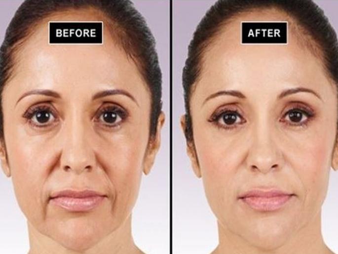 Know the benefits of fecial exercise for glowing skin myb | महागड्या क्रिममुळेही येणार नाही, असा ग्लो देतील 'या' फेशियल एक्सरसाईज