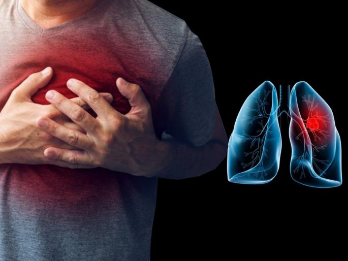 How to prevent from lungs Fungal infections myb | कोरोनापेक्षाही जास्त त्रासदायक असतं फुप्फुसाचं फंगल इन्फेक्शन, जाणून घ्या बचावाचे उपाय How to prevent from lungs Fungal infections myb | कोरोनापेक्षाही जास्त त्रासदायक असतं फुप्फुसाचं फंगल इन्फेक्शन, जाणून घ्या बचावाचे उपाय