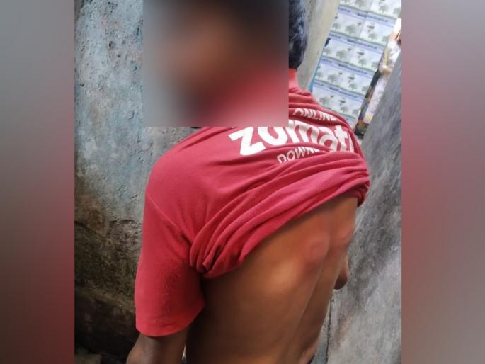 Went to give online delivery; Beaten Up Mercilessly By Police As Country Enters Lockdown pda | लॉकडाऊनमध्ये ऑनलाईन डिलिव्हरी द्यायला गेला; पोलिसांच्या दांड्याचा प्रसाद खावा लागला