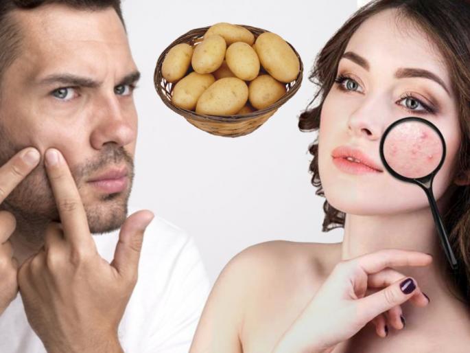 Row Potato benefits of skin potato can remove dark circles myb | लॉकडाऊनमध्ये पार्लरला सुट्टी? घरच्याघरी बटाटा वापरून मिळवा सुरकुत्या, टॅनिंगपासून सुटका Row Potato benefits of skin potato can remove dark circles myb | लॉकडाऊनमध्ये पार्लरला सुट्टी? घरच्याघरी बटाटा वापरून मिळवा सुरकुत्या, टॅनिंगपासून सुटका