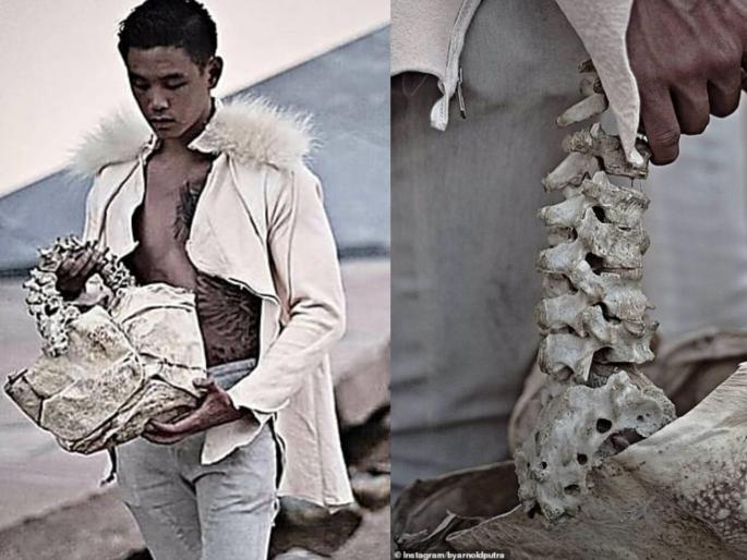 Instagram handbag made alligator tongue human spine myb | बापरे! मानवी हाडांपासूनच तयार केली बॅग, किंमत वाचून व्हाल अवाक्.... Instagram handbag made alligator tongue human spine myb | बापरे! मानवी हाडांपासूनच तयार केली बॅग, किंमत वाचून व्हाल अवाक्....