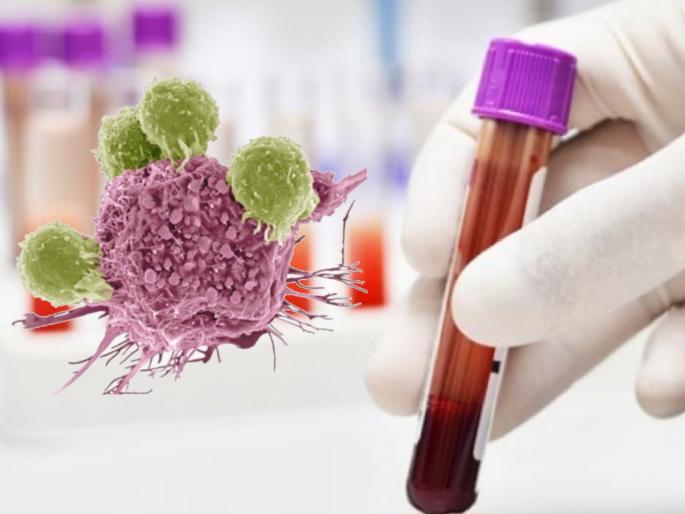 New research of blood test detect it before the symptoms myb | खुषखबर! आता लक्षणं नसतानाही डिटेक्ट होणार कॅन्सर; जाणून घ्या, कसा? New research of blood test detect it before the symptoms myb | खुषखबर! आता लक्षणं नसतानाही डिटेक्ट होणार कॅन्सर; जाणून घ्या, कसा?