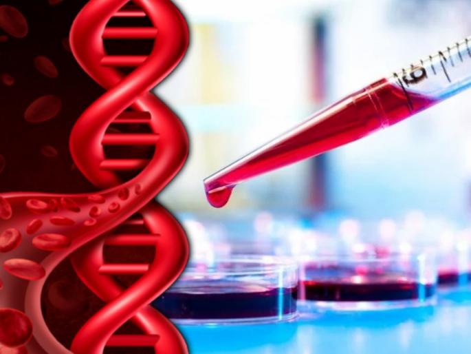 Know about thalassemia causes symptoms and treatment myb | तुमच्यामुळे तुमची मुलंही होऊ शकतात थॅलेसेमियाची शिकार; जाणून घ्या लक्षणं आणि उपाय