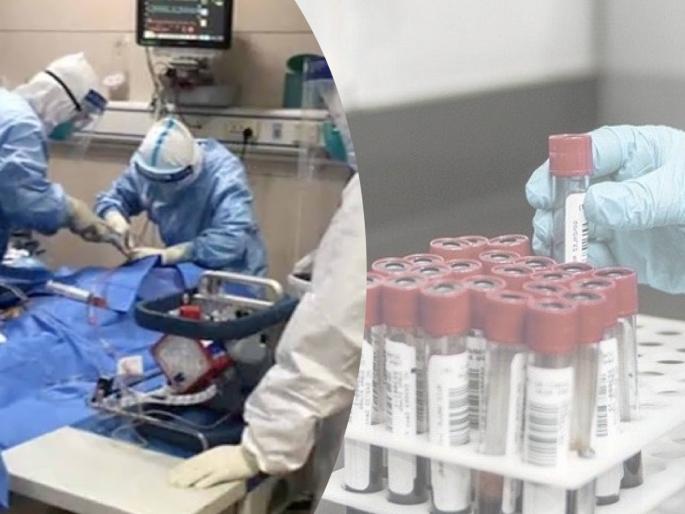CoronaVirus Marathi News Total cases in the country now 67152 SSS | CoronaVirus News : कोरोनाचा उद्रेक! गेल्या 24 तासांत रुग्णसंख्येत विक्रमी वाढ, चिंता वाढवणारी आकडेवारी CoronaVirus Marathi News Total cases in the country now 67152 SSS | CoronaVirus News : कोरोनाचा उद्रेक! गेल्या 24 तासांत रुग्णसंख्येत विक्रमी वाढ, चिंता वाढवणारी आकडेवारी