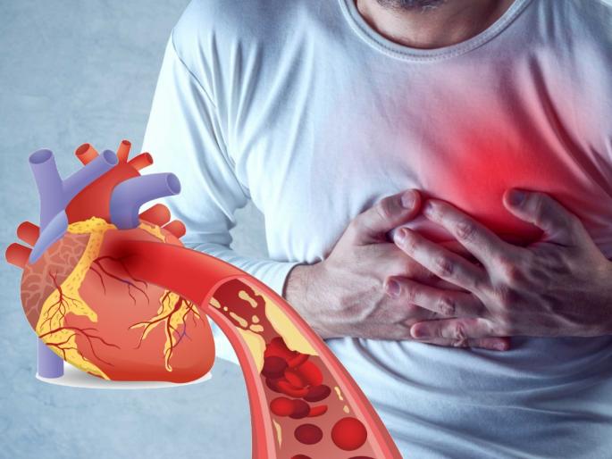 How to control Cholesterol level and prevent from heart disease myb | फक्त आहारच नाही तर 'या' कारणांमुळे घरबसल्या वाढतंय कॉलेस्ट्रॉल, 'असं' करा कंट्रोल
