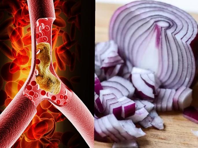 Can onions help control cholesterol levels myb | धमन्यांमध्ये वाढलेलं कॉलेस्ट्रॉल कमी करण्यासाठी इफेक्टिव्ह ठरेल कांदा, 'असा' करा वापर Can onions help control cholesterol levels myb | धमन्यांमध्ये वाढलेलं कॉलेस्ट्रॉल कमी करण्यासाठी इफेक्टिव्ह ठरेल कांदा, 'असा' करा वापर