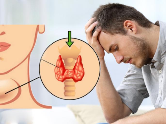 Iodine deficiency in the body can be the cause of infection, know home remedies myb | शरीरातील आयोडिनची कमतरताही ठरू शकते इन्फेक्शनचं कारण; जाणून घ्या उपाय Iodine deficiency in the body can be the cause of infection, know home remedies myb | शरीरातील आयोडिनची कमतरताही ठरू शकते इन्फेक्शनचं कारण; जाणून घ्या उपाय