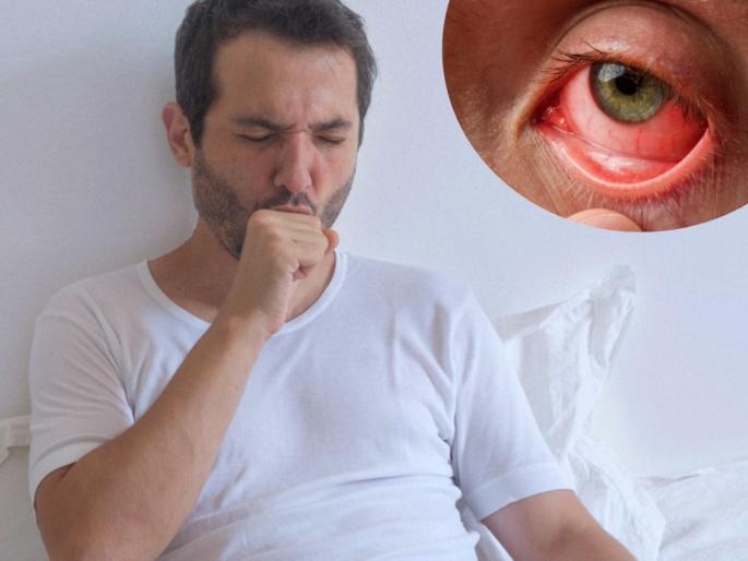 Agra city conjunctivitis cases increased in the month of july need to take precautions jagran special | ...अन्यथा डोळे लाल होतील; इन्फेक्शनपासून वाचण्यासाठी 'हा' करा उपाय Agra city conjunctivitis cases increased in the month of july need to take precautions jagran special | ...अन्यथा डोळे लाल होतील; इन्फेक्शनपासून वाचण्यासाठी 'हा' करा उपाय