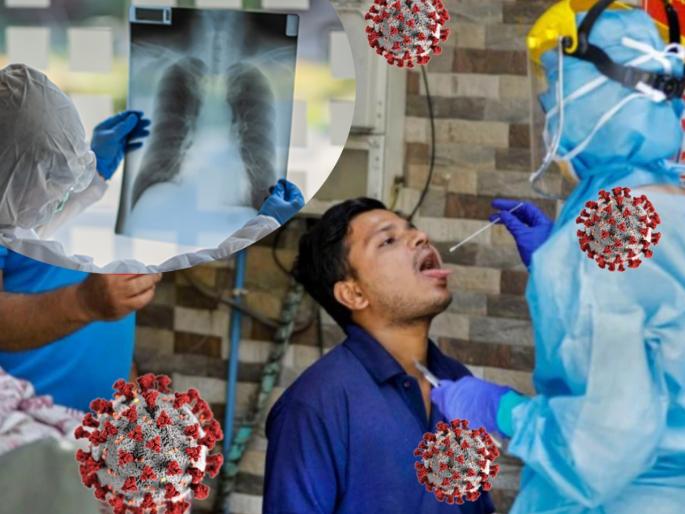 Coronavirus test only in 100 rupees within few seconds software develops by iiit bhagalpur | आता काही सेकंदात फक्त १०० रुपयात होणार कोरोनाची चाचणी ; IIT च्या तज्ज्ञांचे संशोधन Coronavirus test only in 100 rupees within few seconds software develops by iiit bhagalpur | आता काही सेकंदात फक्त १०० रुपयात होणार कोरोनाची चाचणी ; IIT च्या तज्ज्ञांचे संशोधन