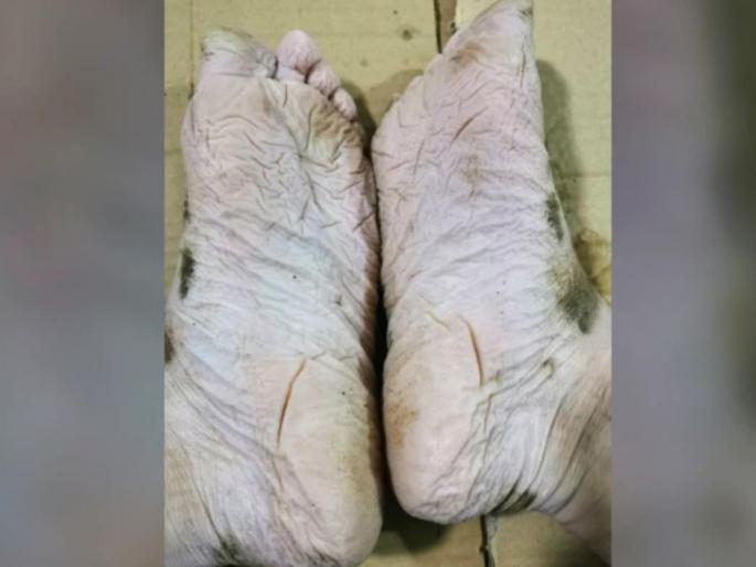 Chinese firefighters feet pics after 30 hour works go viral online | हृदयद्रावक! तब्बल ३० तासांच्या बचावकार्यानंतर सैनिकाच्या पायांची झाली 'अशी' अवस्था Chinese firefighters feet pics after 30 hour works go viral online | हृदयद्रावक! तब्बल ३० तासांच्या बचावकार्यानंतर सैनिकाच्या पायांची झाली 'अशी' अवस्था