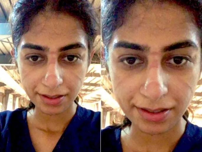 Doctor photo viral after completing covid 19 shift with mark on face | सेल्यूट! २४ तासांची शिफ्ट केलेल्या डॉक्टरच्या चेहऱ्याची अवस्था पाहून तुम्हीही ठोकाल सलाम  Doctor photo viral after completing covid 19 shift with mark on face | सेल्यूट! २४ तासांची शिफ्ट केलेल्या डॉक्टरच्या चेहऱ्याची अवस्था पाहून तुम्हीही ठोकाल सलाम