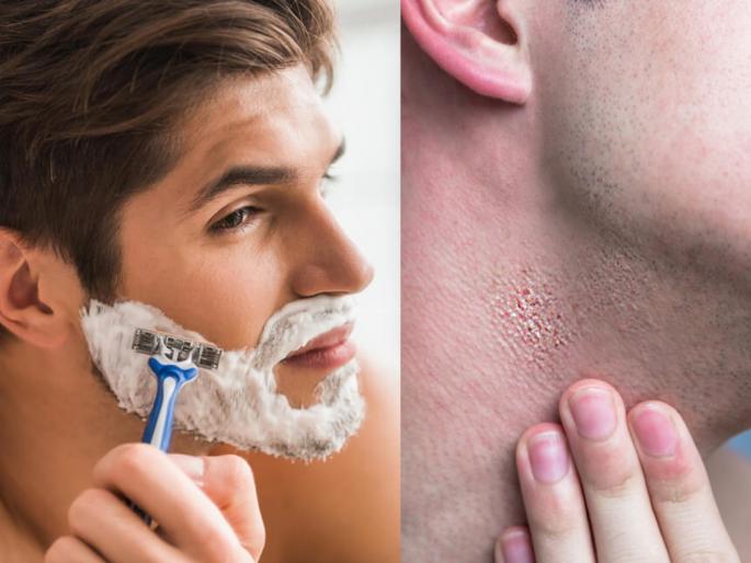 Tips For avoid burning after shaving Know easy Home remedies | तुम्हालाही दाढी केल्यानंतर जळजळ आणि खाज येते? 'या' ५ उपायांनी समस्या होईल कायमची दूर Tips For avoid burning after shaving Know easy Home remedies | तुम्हालाही दाढी केल्यानंतर जळजळ आणि खाज येते? 'या' ५ उपायांनी समस्या होईल कायमची दूर