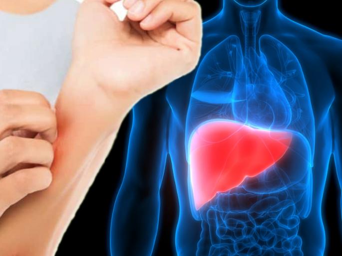 Itching on the skin can be a symptom of liver disease, Knoe symptoms | त्वचेवर सतत येणारी खाज असू शकते लिव्हरच्या 'या' आजाराचं लक्षणं; वेळीच सावध व्हा
