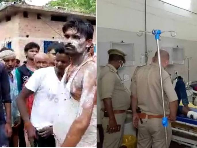Acid attack over disputed on water in villeage of uttar pradesh, 23 people burn | खळबळजनक! पाणी भरण्यावरून झालेल्या वादातून केला अॅसिड हल्ला, २३ जण जळाले Acid attack over disputed on water in villeage of uttar pradesh, 23 people burn | खळबळजनक! पाणी भरण्यावरून झालेल्या वादातून केला अॅसिड हल्ला, २३ जण जळाले