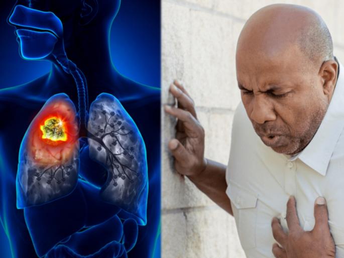 Health Tips In marathi : These 'Self care tips' will be protect from lung diseases | फुफ्फुसांच्या आजारांना लांब ठेवण्यााठी 'सेल्फ केयर टिप्स' ठरतील प्रभावी, नेहमी राहाल निरोगी Health Tips In marathi : These 'Self care tips' will be protect from lung diseases | फुफ्फुसांच्या आजारांना लांब ठेवण्यााठी 'सेल्फ केयर टिप्स' ठरतील प्रभावी, नेहमी राहाल निरोगी