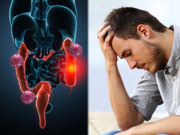 Young people at more risk for colorectal cancer how to spot the signs | तरूणांमध्ये वाढतोय 'कोलोरेक्टल कॅन्सर'चा धोका; वेळीच जाणून घ्या लक्षणं आणि कारणं Young people at more risk for colorectal cancer how to spot the signs | तरूणांमध्ये वाढतोय 'कोलोरेक्टल कॅन्सर'चा धोका; वेळीच जाणून घ्या लक्षणं आणि कारणं