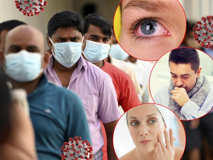 Coronavirus symptoms the most unusual side effects people report after covid diagnosis | CoronaVirus : समोर आली कोरोनाची नवीन ३ लक्षणं; दुर्लक्ष केल्यास वाढू शकतो संसर्गाचा धोका Coronavirus symptoms the most unusual side effects people report after covid diagnosis | CoronaVirus : समोर आली कोरोनाची नवीन ३ लक्षणं; दुर्लक्ष केल्यास वाढू शकतो संसर्गाचा धोका