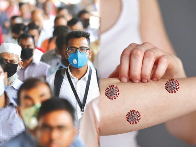CoronaVirus News : Coronavirus can survive around 9 hours on human skin news study | CoronaVirus : काळजी वाढली! मानवी त्वचेवर ९ तास जीवंत राहू शकतो कोरोना विषाणू; तज्ज्ञांचा दावा