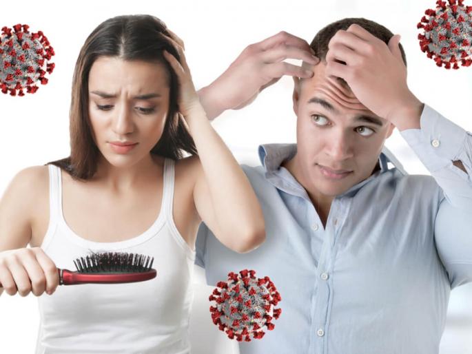 Coronavirus News : Here is why covid patients experience loss of hair | ....म्हणून कोरोना संक्रमण झाल्यानंतर केस गळण्याची समस्या उद्भवते, तज्ज्ञांचा खुलासा Coronavirus News : Here is why covid patients experience loss of hair | ....म्हणून कोरोना संक्रमण झाल्यानंतर केस गळण्याची समस्या उद्भवते, तज्ज्ञांचा खुलासा