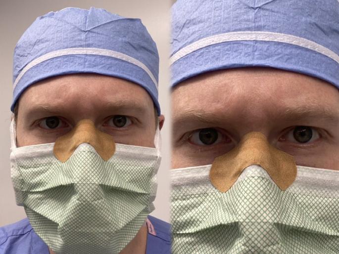 Doctor jugaad to stop glasses fogging up while wearing a face mask goes viral | भारीच! आता मास्कमुळे चष्म्यावर येणार नाही फॉग; व्हायरल झाली डॉक्टरांची भन्नाट ट्रिक Doctor jugaad to stop glasses fogging up while wearing a face mask goes viral | भारीच! आता मास्कमुळे चष्म्यावर येणार नाही फॉग; व्हायरल झाली डॉक्टरांची भन्नाट ट्रिक