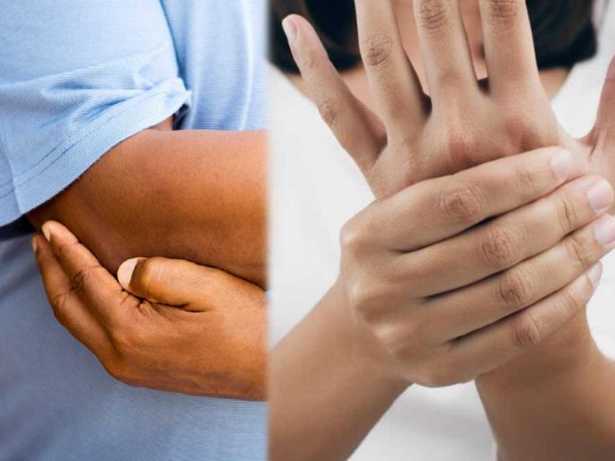 Women with rare guillain barre syndrome post covid treated at mumbais global hospital | काळजी वाढली! कोरोनामुक्त झालेल्यांना 'गुलियन बॅरी सिंड्रोम' या आजाराचा धोका, जाणून घ्या लक्षणं Women with rare guillain barre syndrome post covid treated at mumbais global hospital | काळजी वाढली! कोरोनामुक्त झालेल्यांना 'गुलियन बॅरी सिंड्रोम' या आजाराचा धोका, जाणून घ्या लक्षणं