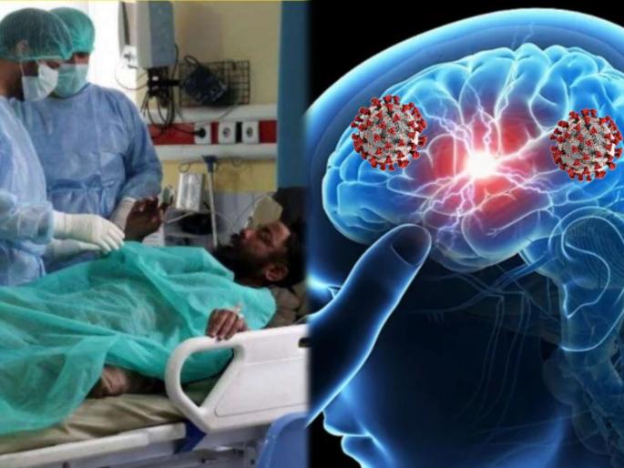 Coronavirus updates corona virus may enter brain through nose study | काळजी वाढली! फक्त फुफ्फुसंच नाही तर नाकावाटे मेंदूपर्यंत पोहचतोय करोनाचा व्हायरस Coronavirus updates corona virus may enter brain through nose study | काळजी वाढली! फक्त फुफ्फुसंच नाही तर नाकावाटे मेंदूपर्यंत पोहचतोय करोनाचा व्हायरस