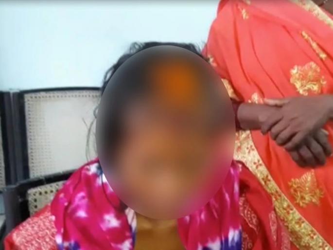 The lover cut the hair of the boy friend's bride | आश्चर्यकारक! असा घेतला सूड; प्रेयसीने प्रियकराच्या भावी पत्नीचे केस कापले अन् फेविक्विकने डोळे चिटकवले The lover cut the hair of the boy friend's bride | आश्चर्यकारक! असा घेतला सूड; प्रेयसीने प्रियकराच्या भावी पत्नीचे केस कापले अन् फेविक्विकने डोळे चिटकवले