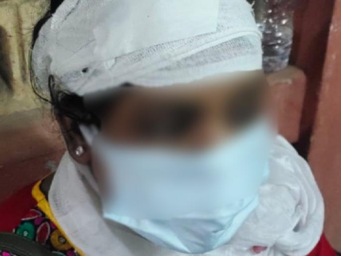 Not wearing a mask, the womens put a clean-up marshal's head on a paver block | मास्क न घालण्यावरून महिलांनी क्लीन अप मार्शलच्या डोक्यात घातला पेव्हर ब्लॉक 