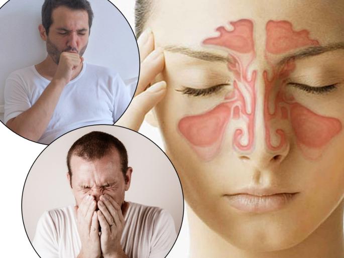 Sinus disease home treatment remedies cure best home remedies for sinus infection | हिवाळ्यात शिंका, सर्दीच्या समस्येने हैराण आहात; 'या' घरगुती उपायांनी सायनसची समस्या होईल दूर Sinus disease home treatment remedies cure best home remedies for sinus infection | हिवाळ्यात शिंका, सर्दीच्या समस्येने हैराण आहात; 'या' घरगुती उपायांनी सायनसची समस्या होईल दूर