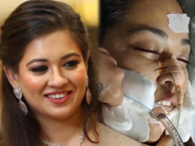 Fighting with death continues, in-law family trying to kill for dowry allegations | मृत्यूशी झुंज सुरूय, हुंड्यासाठी सासरच्यांनी जीवे ठार मारण्याचा प्रयत्न केल्याचा आरोप Fighting with death continues, in-law family trying to kill for dowry allegations | मृत्यूशी झुंज सुरूय, हुंड्यासाठी सासरच्यांनी जीवे ठार मारण्याचा प्रयत्न केल्याचा आरोप