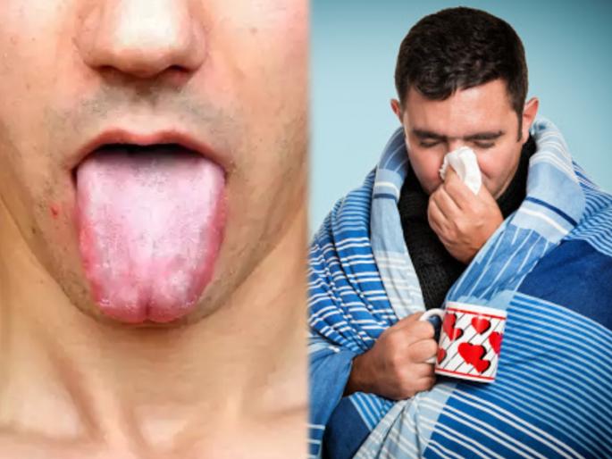 White tongue why it happens and how to treat it at home | आजारी पडण्यासाठी कारणीभूत ठरतोय तुमच्या जीभेवरील पांढरा थर; या उपायांनी फक्त २ मिनिटात जीभ करा स्वच्छ White tongue why it happens and how to treat it at home | आजारी पडण्यासाठी कारणीभूत ठरतोय तुमच्या जीभेवरील पांढरा थर; या उपायांनी फक्त २ मिनिटात जीभ करा स्वच्छ
