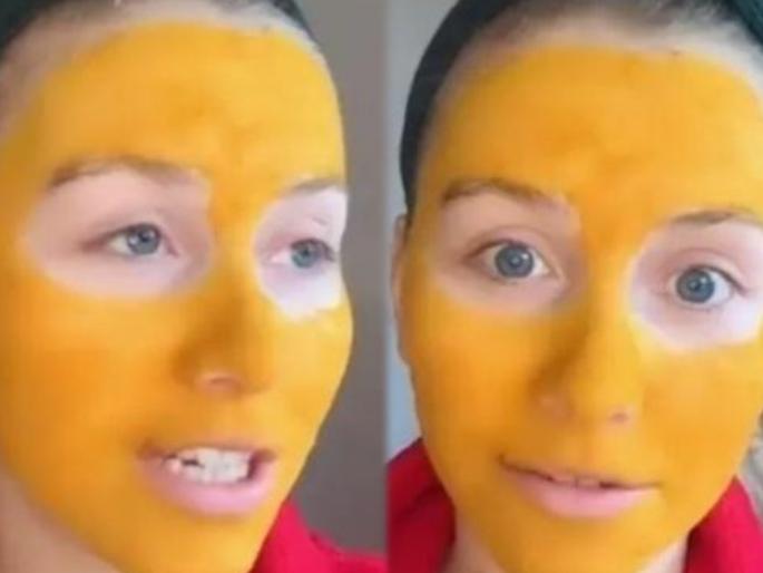 Viral News in Marathi : Turmeric facemask turn woman face yellow | बोंबला! ग्लोईंग त्वचेच्या नादात हळदीचा फेसपॅक लावायला गेली; अन् अख्ख्या चेहऱ्यावर झालं असं काही... Viral News in Marathi : Turmeric facemask turn woman face yellow | बोंबला! ग्लोईंग त्वचेच्या नादात हळदीचा फेसपॅक लावायला गेली; अन् अख्ख्या चेहऱ्यावर झालं असं काही...