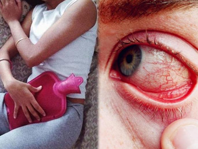 Woman in chandigarh has got blood eyes whenever she is on periods and the doctors tell the reason | बापरे! मासिक पाळीदरम्यान तरूणीच्या डोळ्यातून आले रक्ताचे अश्रू; समोर आला 'हा' दुर्मिळ आजार Woman in chandigarh has got blood eyes whenever she is on periods and the doctors tell the reason | बापरे! मासिक पाळीदरम्यान तरूणीच्या डोळ्यातून आले रक्ताचे अश्रू; समोर आला 'हा' दुर्मिळ आजार