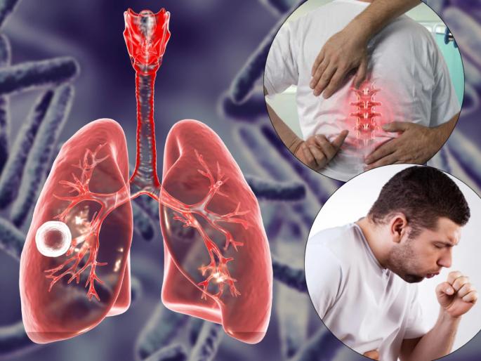 Is TB as contagious as the corona virus? Know Experts openion | सध्याच्या दिवसात टीबी हा कोरोना व्हायरसइतकाच संसर्गजन्य होतोय? तज्ज्ञ सांगतात की... Is TB as contagious as the corona virus? Know Experts openion | सध्याच्या दिवसात टीबी हा कोरोना व्हायरसइतकाच संसर्गजन्य होतोय? तज्ज्ञ सांगतात की...