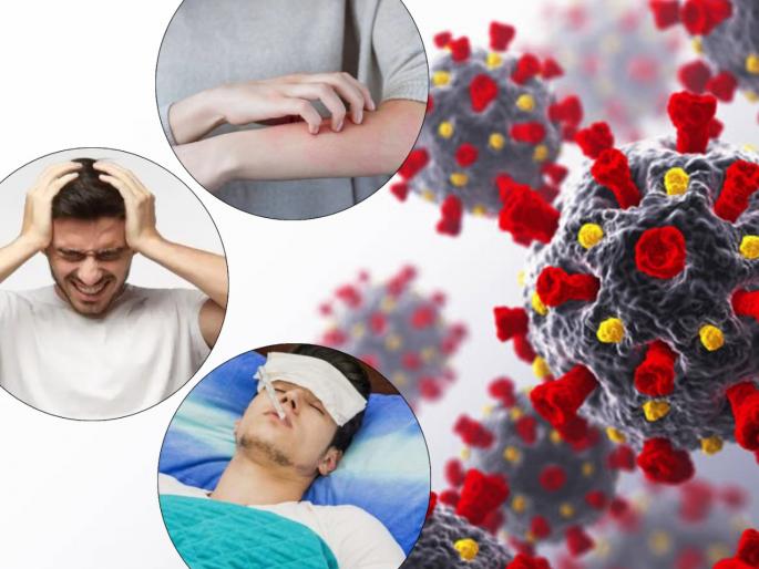 CoronaVirus News: Covid-19 cases latest update coronavirus new strain symptoms in india | CoronaVirus News : भारतात कोरोनाच्या दुसऱ्या लाटेचा उद्रेक; समोर आली कोरोनाच्या नव्या स्ट्रेनची लक्षणं
