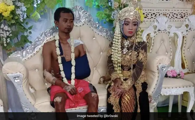 groom tied a bandage instead of clothes at the wedding | लग्नामध्ये कपड्यांऐवजी बँडेज बांधून बसला नवरदेव, व्हायरल फोटो पाहून लोक म्हणाले...