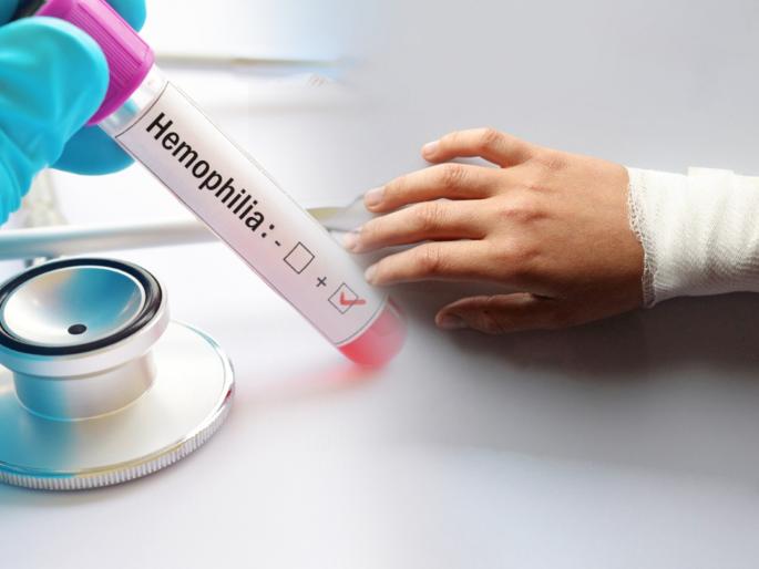 World hemophilia day 2021: What is hemophilia, why do people get scared in the name of this disease? | World hemophilia day 2021: काय आहे हेमोफीलिया, या आजाराच्या नावानं लोक का घाबरतात? World hemophilia day 2021: What is hemophilia, why do people get scared in the name of this disease? | World hemophilia day 2021: काय आहे हेमोफीलिया, या आजाराच्या नावानं लोक का घाबरतात?