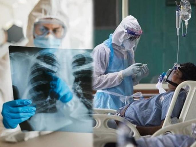 CoronaVirus News : Corona virus can affect many other organs besides the lungs | CoronaVirus News : धोका वाढला! फुफ्फुसांव्यतिरिक्त 'या' अवयवांवर आक्रमण करतोय कोरोनाचा नवा स्ट्रेन; अशी ओळखा लक्षणं CoronaVirus News : Corona virus can affect many other organs besides the lungs | CoronaVirus News : धोका वाढला! फुफ्फुसांव्यतिरिक्त 'या' अवयवांवर आक्रमण करतोय कोरोनाचा नवा स्ट्रेन; अशी ओळखा लक्षणं