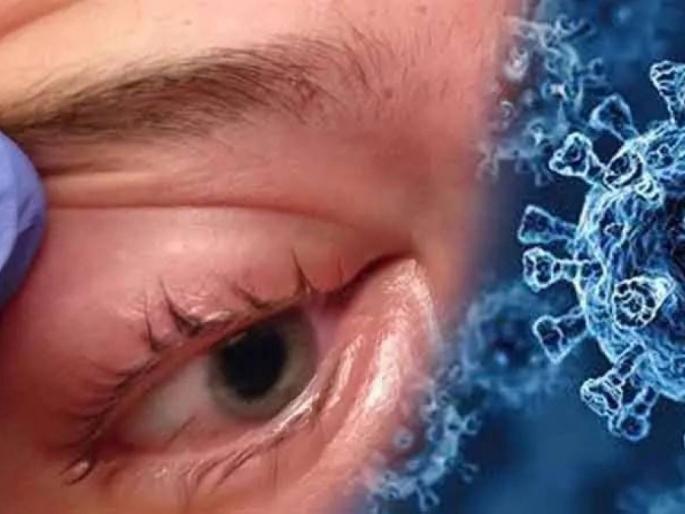 Mucormycosis :This is how mucormycosis attacks the body, these are the causes of infection; Important information provided by Dr. Randeep Guleria | Mucormycosis : म्युकरमायकोसिस अशाप्रकारे करतो शरीरावर हल्ला, ही आहेत संसर्गाची कारणं; तज्ज्ञांनी दिली महत्त्वपूर्ण माहिती