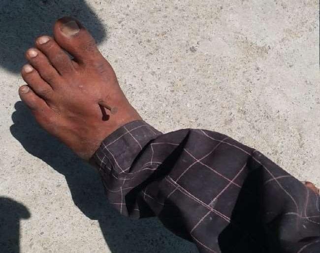 bareilly police accused of hitting nails in hand and leg of man not wearing mask | भयंकर! मास्क लावला नसल्याने पोलिसांनी मुलाच्या हातापायात ठोकला खिळा; महिलेचा गंभीर आरोप bareilly police accused of hitting nails in hand and leg of man not wearing mask | भयंकर! मास्क लावला नसल्याने पोलिसांनी मुलाच्या हातापायात ठोकला खिळा; महिलेचा गंभीर आरोप
