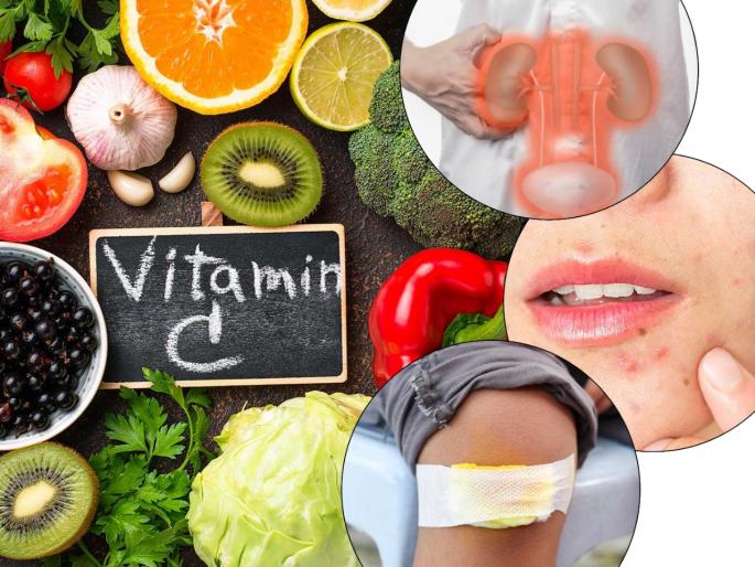 Vitamin c deficiency signs symptoms disease food | या लक्षणांवरून ओळखा शरीरातली व्हिटामीन सी ची कमतरता; त्वचेवरील परिणांमासह दृष्टी जाण्याचाही धोका