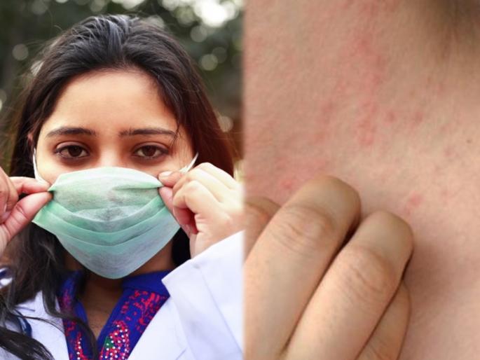 Skin care Tips : If you have skin problems causing of face masks these quick | रॅश, खाज यांना निमित ठरू शकतो तुम्ही वापरत असलेला मास्क; या टिप्सनं चेहऱ्याची घ्या काळजी