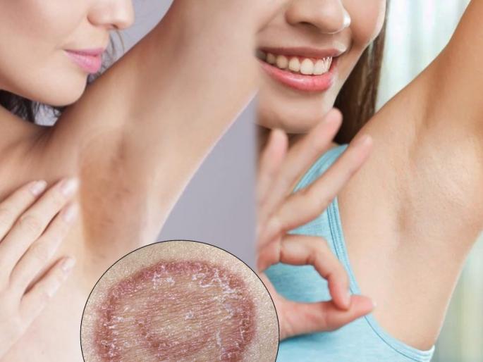 Skin Care Tips : Underarm infection tips to remove underarms hair at home | जास्त घाम जमा झाल्यानं अंडरआर्म्समध्येही होऊ शकतं फंगल इन्फेक्शन; अशी घ्या काळजी