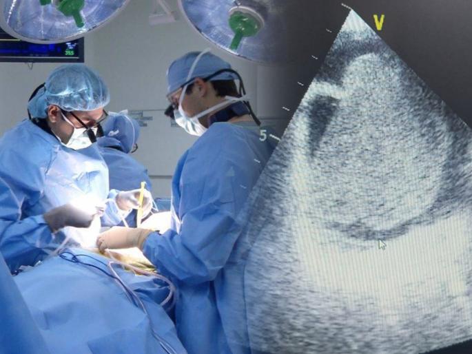 CoronaVirus News 7 cm tumor removed from corona-infected woman's heart in miraroad | CoronaVirus News : कोरोनाबाधित महिलेच्या हृदयातून काढली चक्क ७ सेंटिमीटरची गाठ CoronaVirus News 7 cm tumor removed from corona-infected woman's heart in miraroad | CoronaVirus News : कोरोनाबाधित महिलेच्या हृदयातून काढली चक्क ७ सेंटिमीटरची गाठ