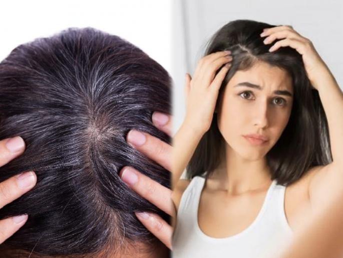 White hairs issue : Causes for gray hair and methods of prevention | White hairs issue : कमी वयातच पांढरे केस लूक बिघडवताहेत? मग सगळ्यात आधी हे उपाय करा, वाचा कारणं