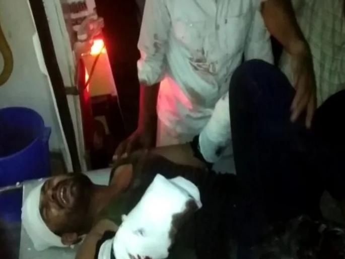 shocking incident, Women sarpanch husband chopped man hands in Madhya Pradesh | महिला सरपंचाच्या पतीची कॉलर पकडली, गावगुंडांनी त्याला तालिबानी शिक्षा दिली, थरकाप उडवणारी घटना shocking incident, Women sarpanch husband chopped man hands in Madhya Pradesh | महिला सरपंचाच्या पतीची कॉलर पकडली, गावगुंडांनी त्याला तालिबानी शिक्षा दिली, थरकाप उडवणारी घटना