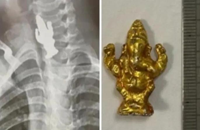 3 year old boy swallows ganesha idol survives after medical treatment in bengaluru | अरे देवा! 3 वर्षीय चिमुकल्याने गिळली गणपतीची मूर्ती, एक्स-रे पाहून डॉक्टरही झाले हैराण अन्... 3 year old boy swallows ganesha idol survives after medical treatment in bengaluru | अरे देवा! 3 वर्षीय चिमुकल्याने गिळली गणपतीची मूर्ती, एक्स-रे पाहून डॉक्टरही झाले हैराण अन्...